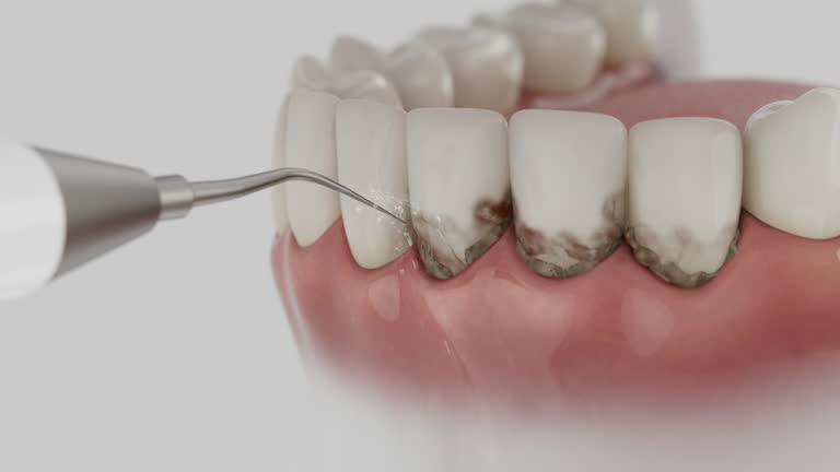 Reliable Dental contractor in Scottsville, NY by Dentist Open Now
